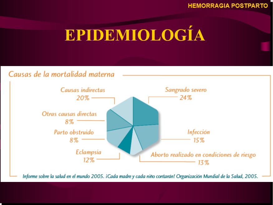 Hemorragia Postparto - PPT