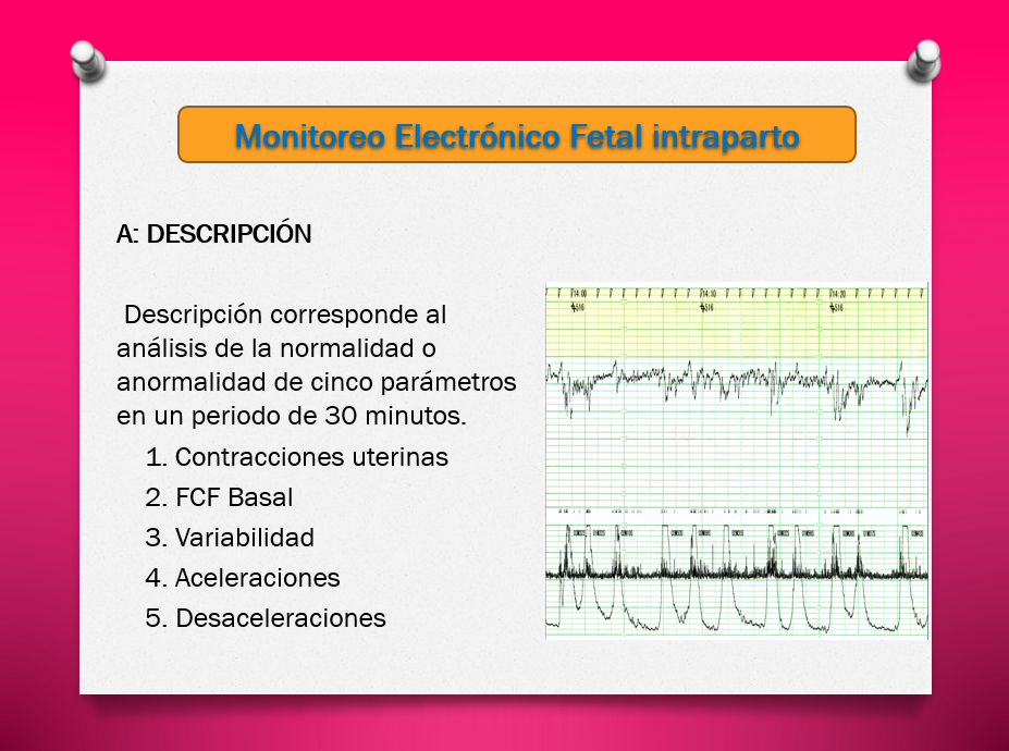 Monitoreo Electrónico fetal Intraparto - PPT