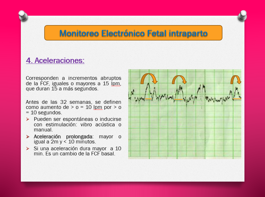 Monitoreo Electrónico fetal Intraparto - PPT