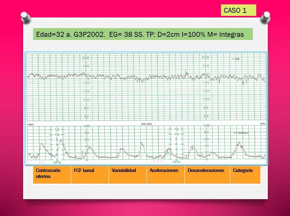 Monitoreo Electrónico fetal Intraparto - PPT