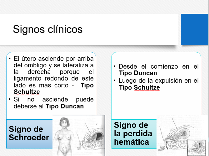 Alumbramiento - PPT