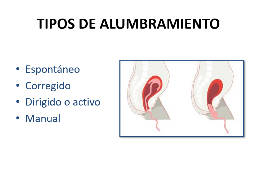 Desprendimiento Y Expulsión De La Placenta - PPT