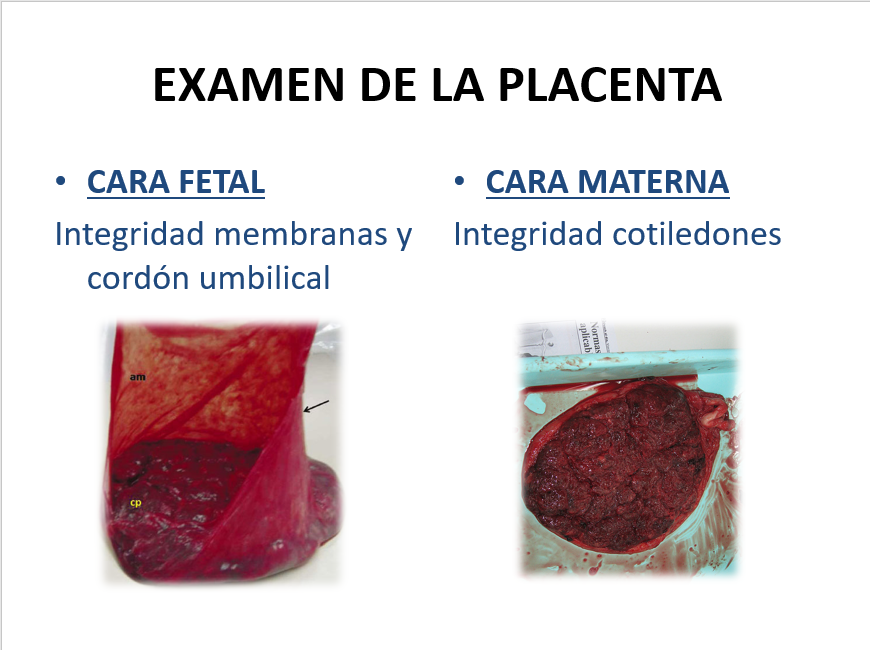 Desprendimiento Y Expulsión De La Placenta - PPT