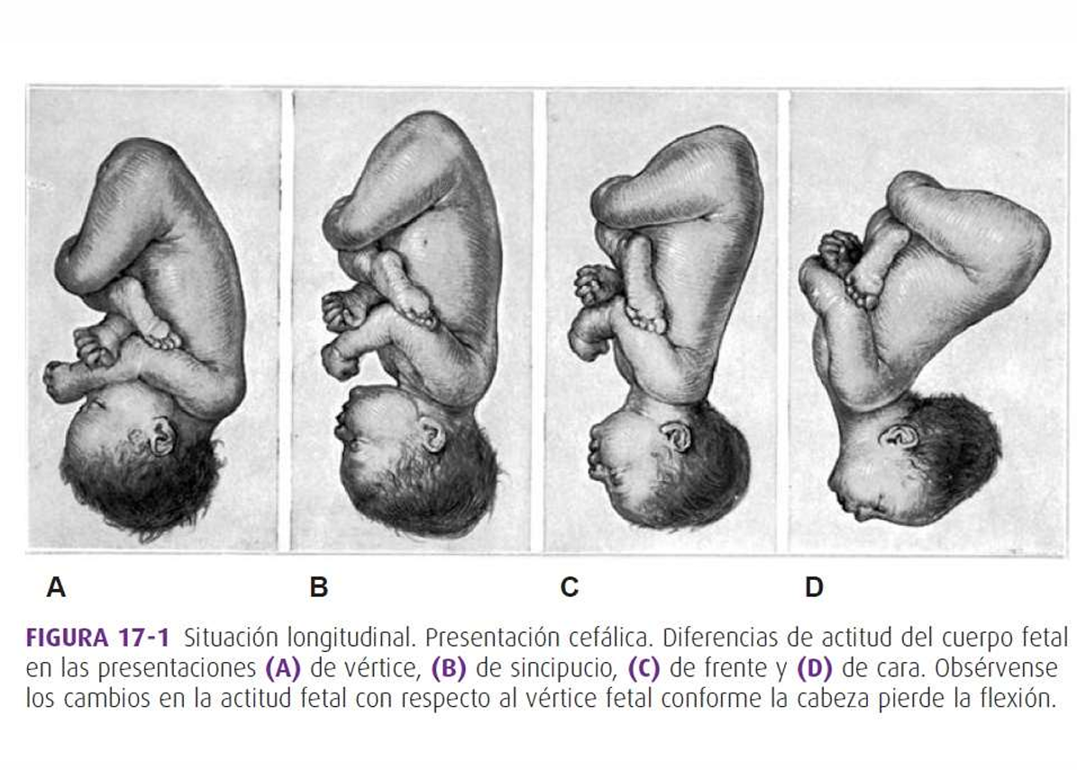 Mecanismo De Parto, Williams - PDF
