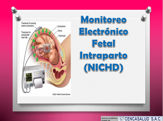 Monitoreo Electrónico fetal Intraparto - PPT