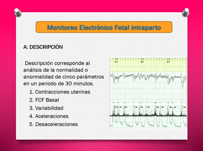 Monitoreo Electrónico fetal Intraparto - PPT
