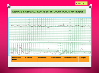 Monitoreo Electrónico fetal Intraparto - PPT