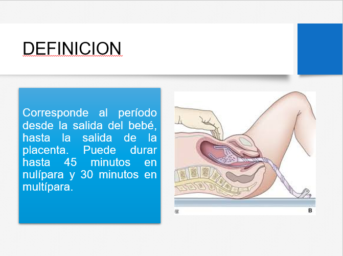 Alumbramiento - PPT