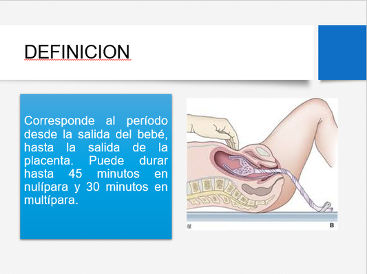 Alumbramiento - PPT