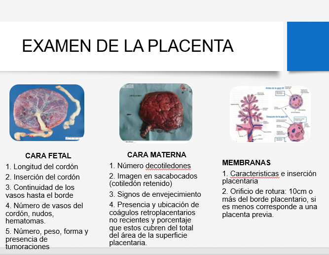 Alumbramiento - PPT