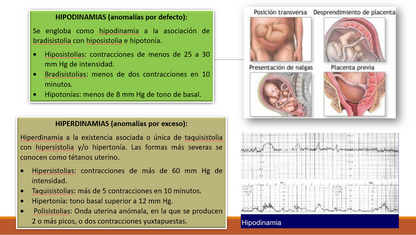 Distocias De La Dinámica Uterina - PPT