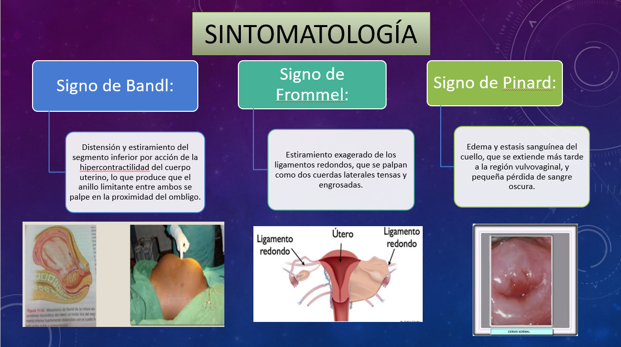 Distocias De La Dinámica Uterina - PPT