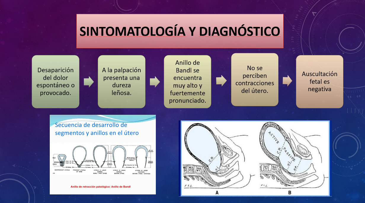 Distocias De La Dinámica Uterina - PPT
