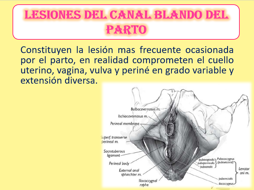 Desgarro Perineal, Cervical y vaginal - PPT