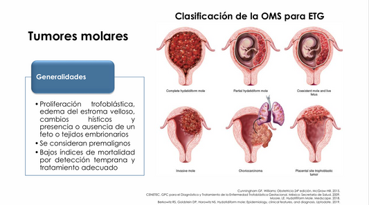 Enfermedad Trofoblástica Gestacional - PDF
