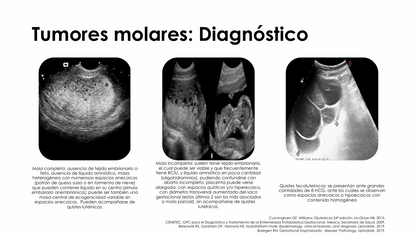 Enfermedad Trofoblástica Gestacional - PDF