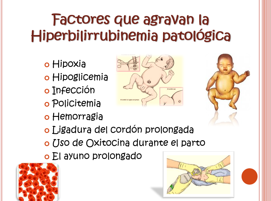 Ictericia Neonatal - PPT