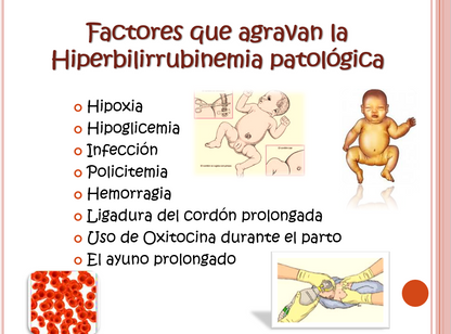 Ictericia Neonatal - PPT