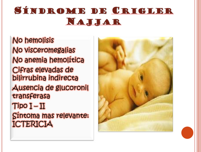 Ictericia Neonatal - PPT