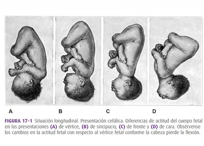 Mecanismo De Parto, Williams - PDF