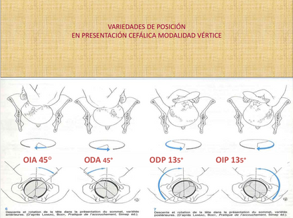 Mecanismo De Parto, Williams - PDF