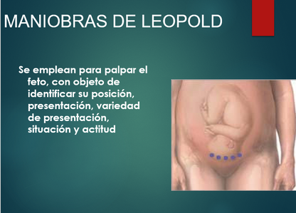 Trabajo De Parto - PPT