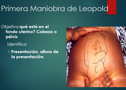 Trabajo De Parto - PPT