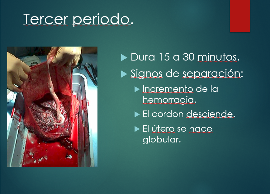 Trabajo De Parto - PPT