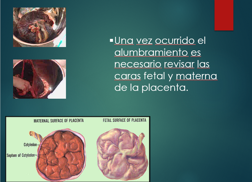 Trabajo De Parto - PPT